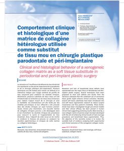 chirurgie-plastique-parodontale